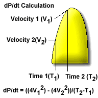 Aortic Valve Gradient