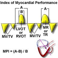 Aortic Valve Gradient