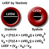 Aortic Valve Gradient