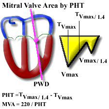 Aortic Valve Gradient